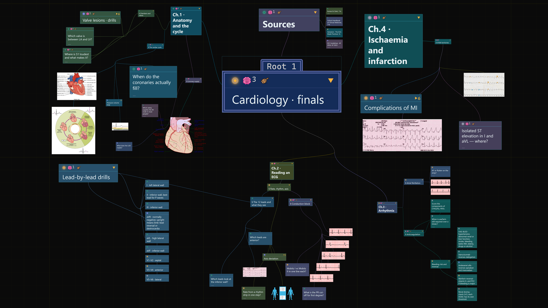 A Cygtree board titled Cardiology finals on a near-black canvas with a fine green grid: five chapters radiate from the root, each card carrying a coloured status dot, and pink brain and gavel marks sit on the chapters that hold memories and judgments. A labelled heart, the cardiac cycle against an ECG, a coronary artery drawing and a dozen rhythm strips on pink ECG paper are pinned around the branches, and a column of twelve lead-by-lead drill cards runs down the left.